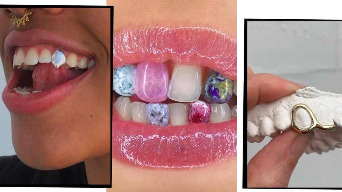 Улыбка на миллион: грилзы для девушек